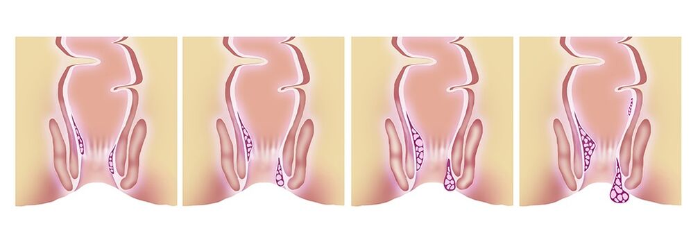 Gelarex efficace à toutes les étapes